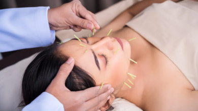 The Role of Facial Acupuncture in Stress Relief