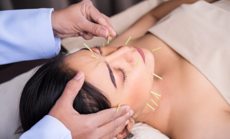 The Role of Facial Acupuncture in Stress Relief