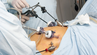 How Gastric Sleeve Surgery Helps Combat Fatty Liver Disease