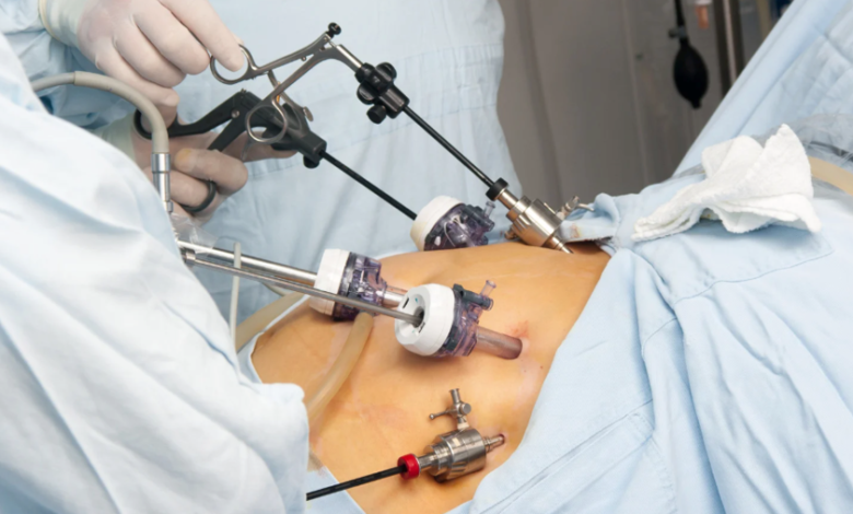 How Gastric Sleeve Surgery Helps Combat Fatty Liver Disease