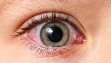 Vision Problems