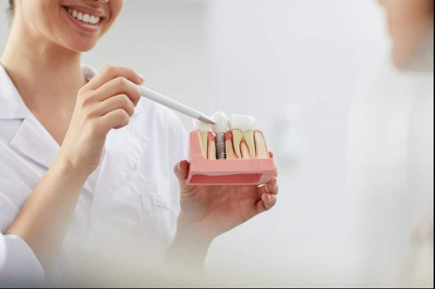 How Periodontal Therapy Prevents Complications In Implant Care