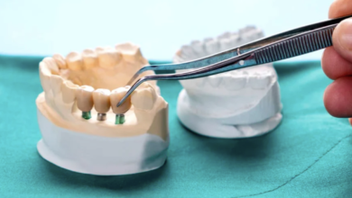 How Guided Surgery Enhances Precision In Implant Dentistry